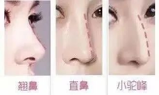 鼻子够挺，就一定好看?快来看看自己适合哪款鼻型! 图片-4
