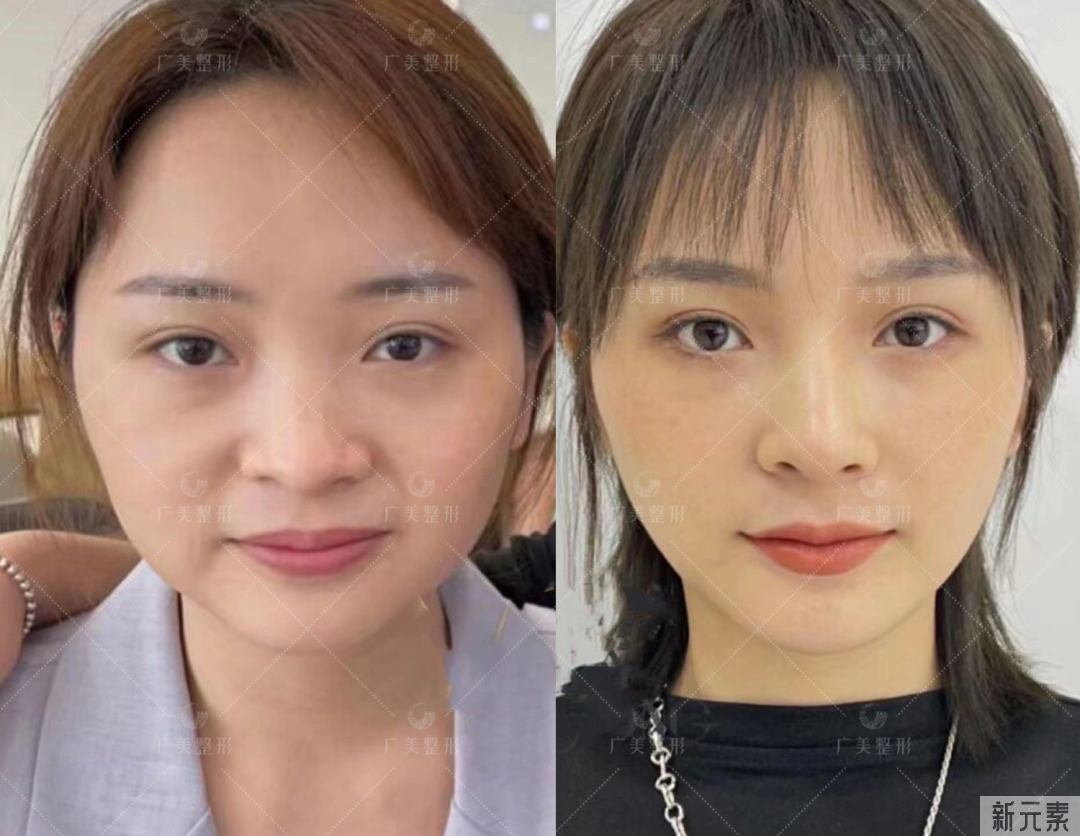 皮肤衰老自测，看你的衰老到了哪个程度? 图片-7