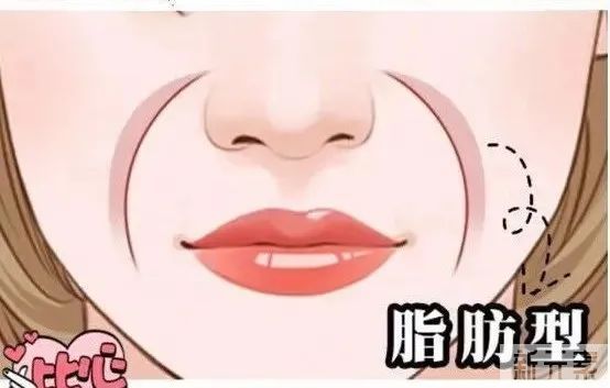 每个人的法令纹都有自己的脾气，具体成因具体改善 图片-6