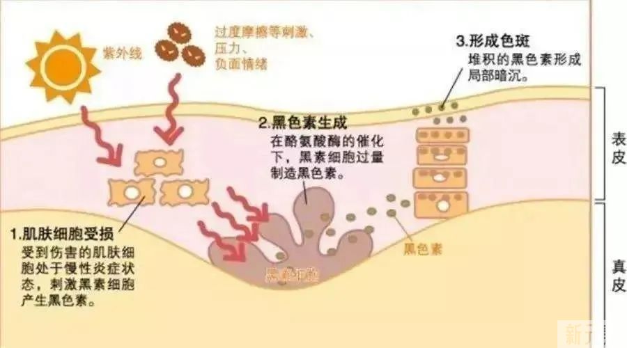 当心!脸上能看到的斑，可能只是冰山一角...... 图片-8