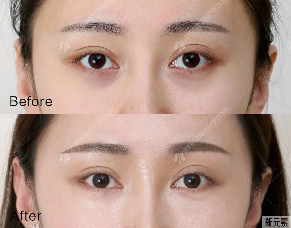 『耐老脸』都有的3个特征，看看你有吗? 图片-13