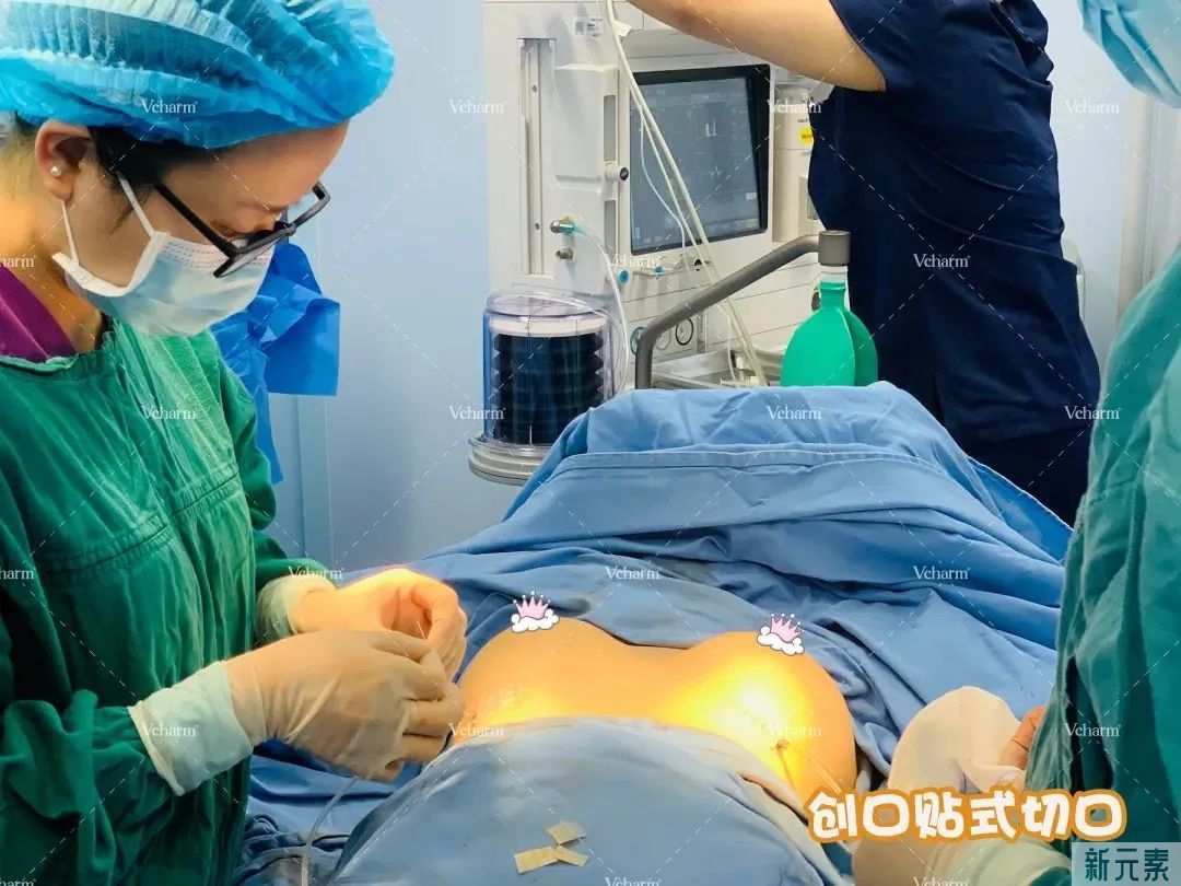 爆哭!原来胸部的形状还分这么多种? 图片-26
