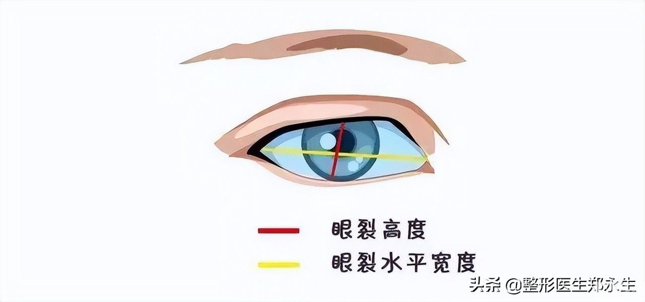 你的双眼皮为什么看起来假，看看你就知道了 图片-4