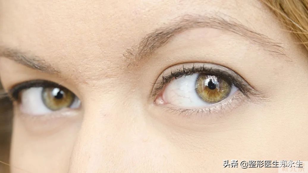 你的双眼皮为什么看起来假，看看你就知道了 图片-5