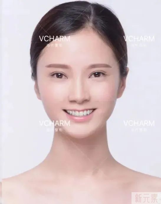 牙齿出现这几种状况，一定要去做矫正! 图片-17