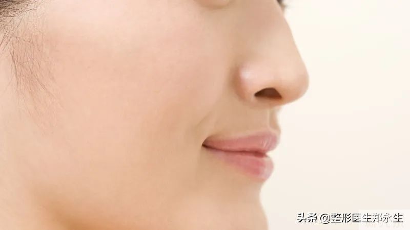 鼻整形术后偏斜的原因分析预防 图片-2