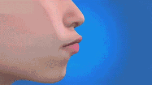 速看!牙齿矫正为什么会失败? 图片-4
