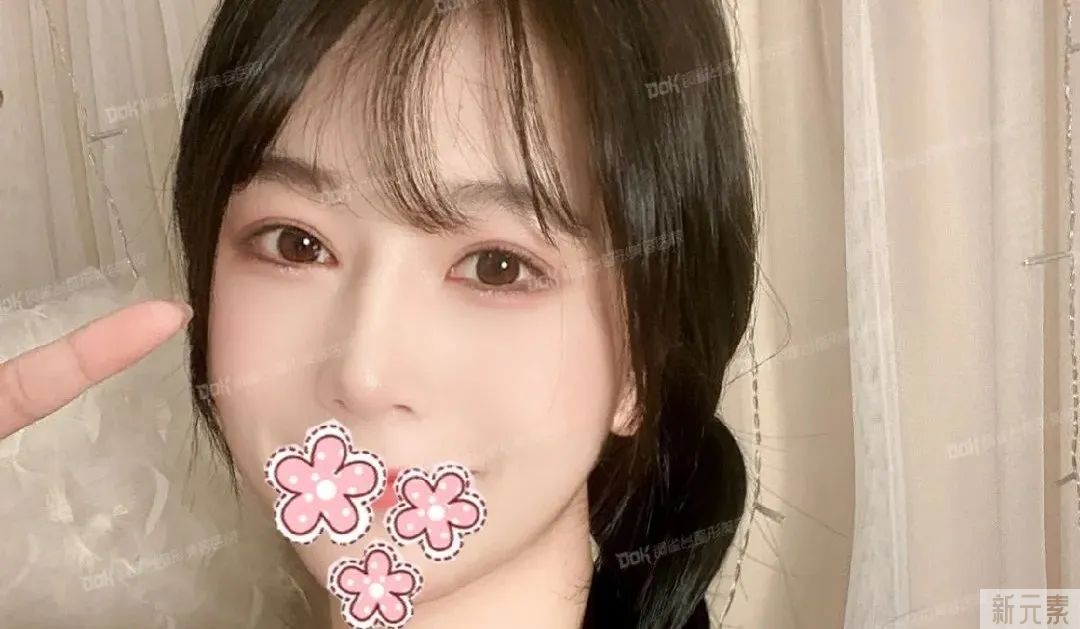 科普 | 美鼻不仅仅是垫高鼻梁那么简单的事，这两条“线”很重要! 图片-25