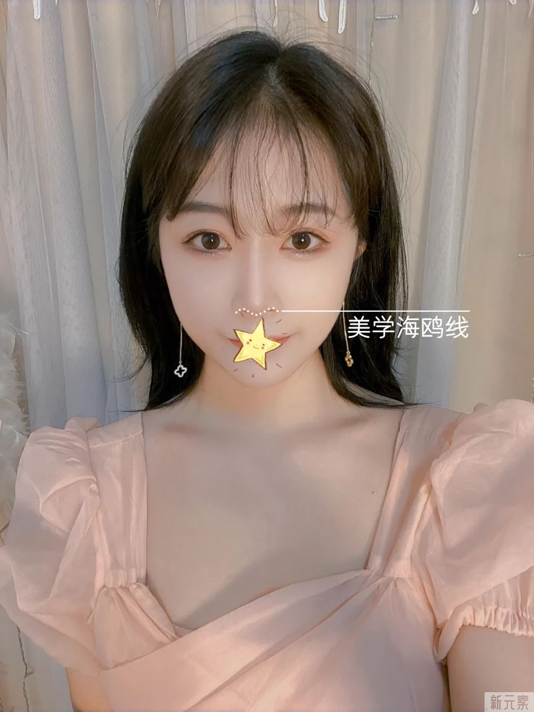 科普 | 美鼻不仅仅是垫高鼻梁那么简单的事，这两条“线”很重要! 图片-18