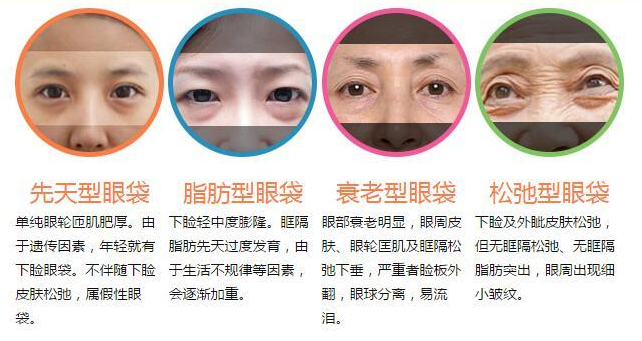 眼袋有多耽误颜值?有了眼袋体感年龄+10岁 图片-8