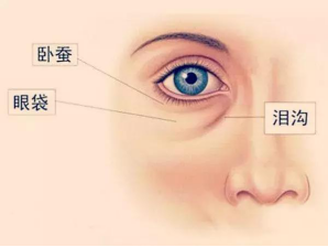 眼袋有多耽误颜值?有了眼袋体感年龄+10岁 图片-11