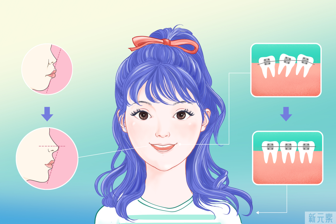 【名医请回答】矫正失败后，还能进行二次矫正吗? 图片-2
