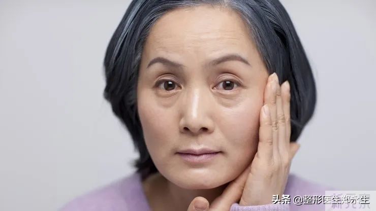 不同类型眼袋的症状和治疗方案 图片-3