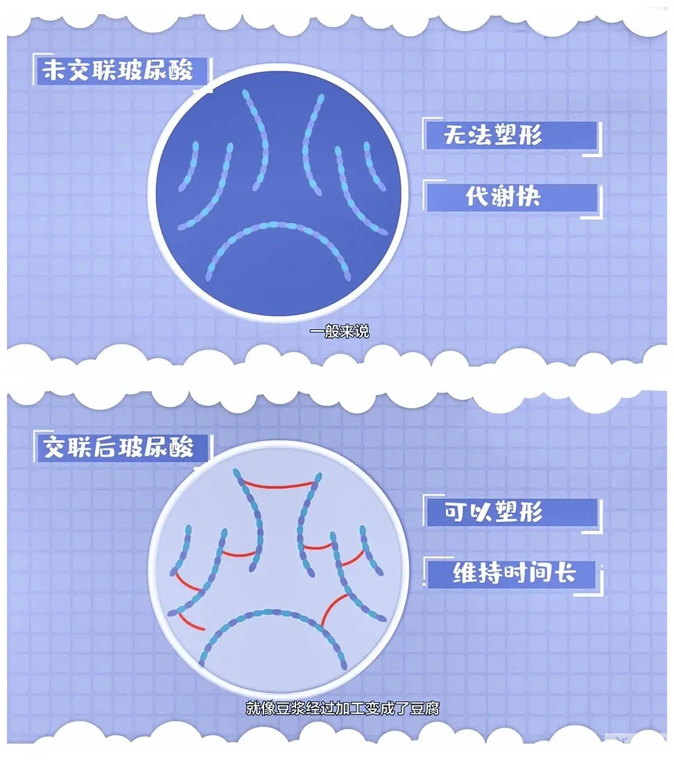 交联玻尿酸和非交联玻尿酸有什么区别?这次终于搞明白啦! 图片-7