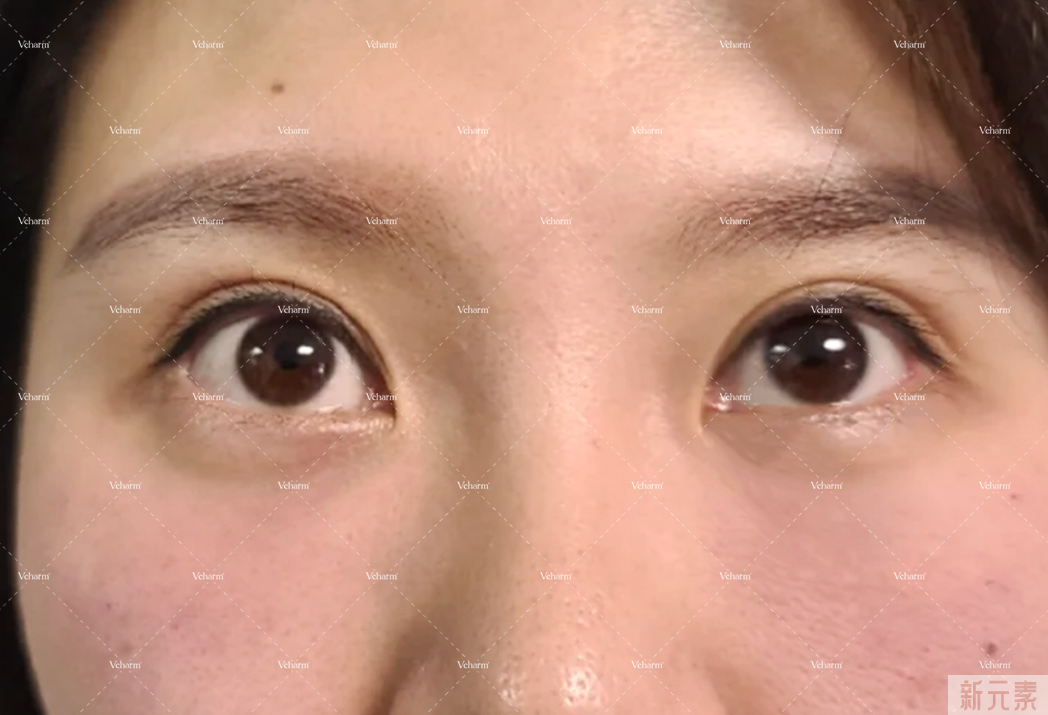 乱补胶原蛋白的你想过后果吗?最有效的方法为你找到了! 图片-21