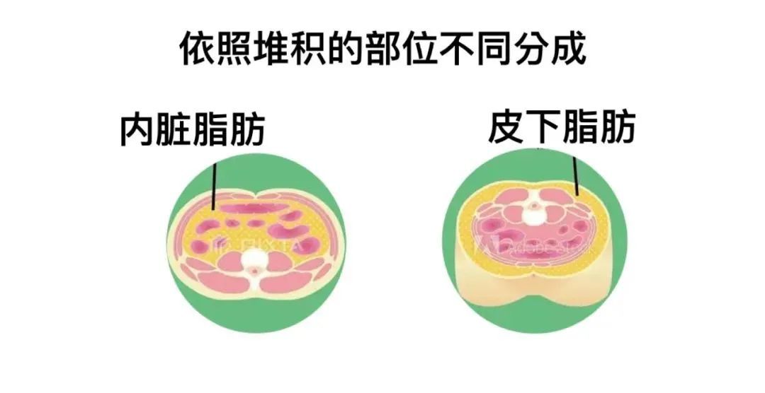 带你了解吸脂手术内些事儿~ 图片-4