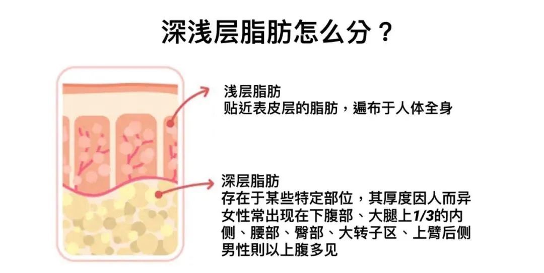 带你了解吸脂手术内些事儿~ 图片-5