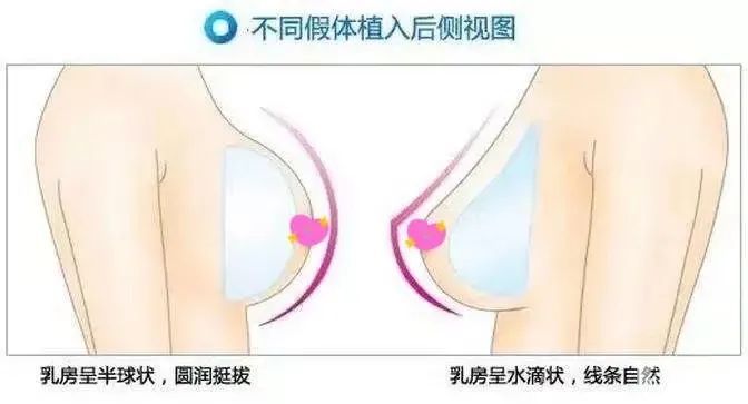 到底是怎样的胸，能让男人看了销魂，女人看了失神! 图片-12