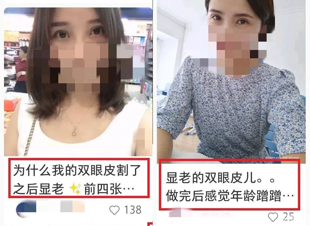 为什么有的人做了双眼皮，更显老? 图片-3