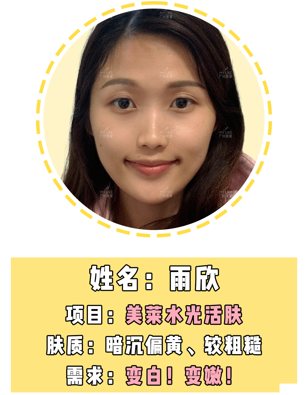 戒油戒辣15年依旧满脸痘....而闺蜜只用了1招 图片-9