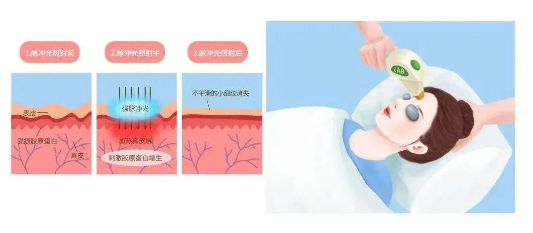 如何改善暗沉肤色? 图片-5