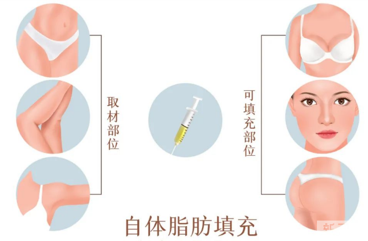 脸这里有了凹陷，不仅显老，还显脸大，怎么补救? 图片-3