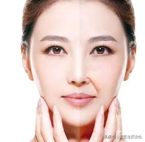 如何轻松去除各种面部皱纹? 图片-5