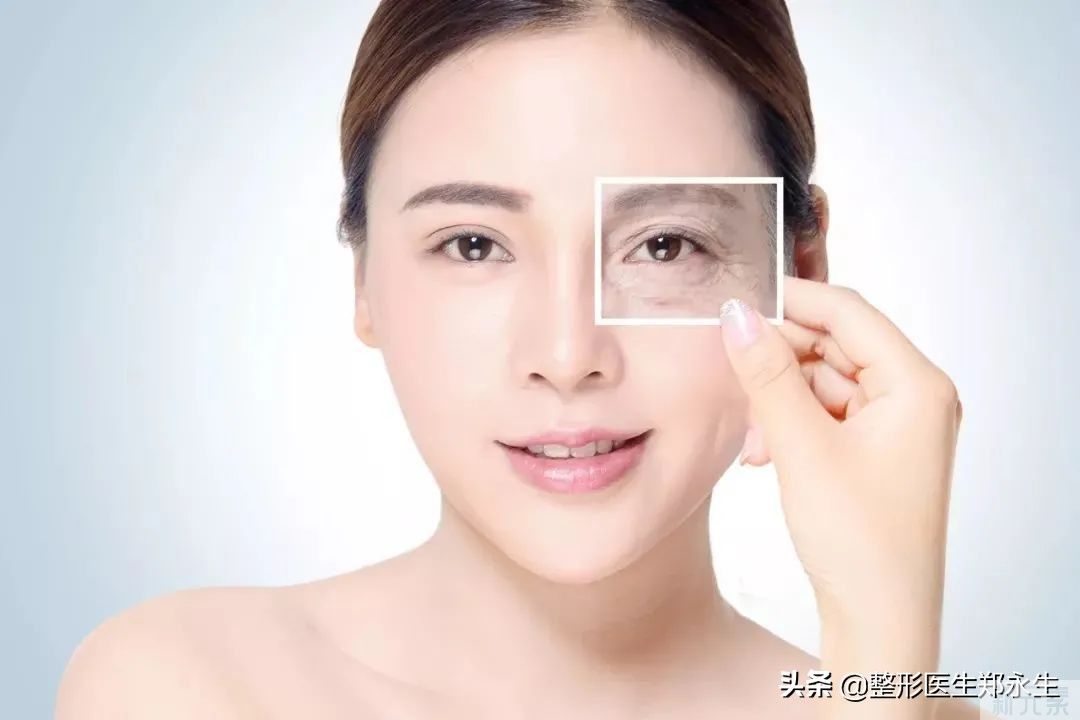 如何轻松去除各种面部皱纹? 图片-2