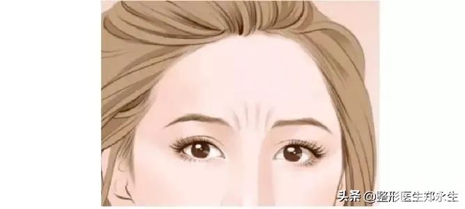 如何轻松去除各种面部皱纹? 图片-3