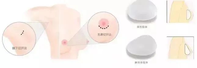 集美们，你对丰胸了解多少呢? 图片-8