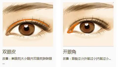 【医美小科普】做双眼皮之前需要注意什么 图片-3