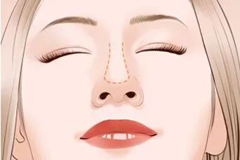 膨体比硅胶的价钱高，是因为膨体好吗?好在哪里呢? 图片-9
