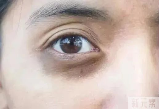 要睡多久觉，才能把黑眼圈睡没? 图片-5