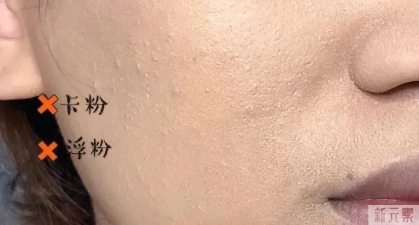 女明星也逃不过的毛孔粗大、橘皮脸，该怎么办? 图片-3