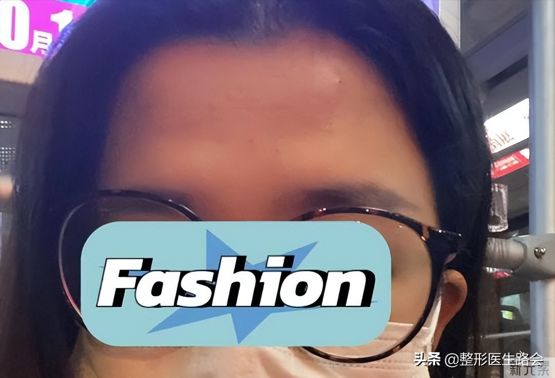 额头不饱满，影响“桃花运”吗? 图片-2