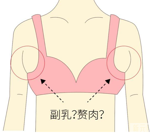 不胖的人也有副乳!它有什么影响以及如何改善? 图片-5