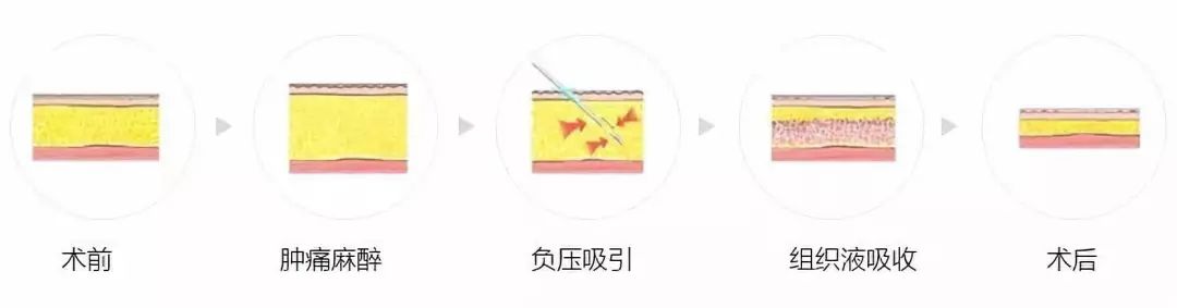 在成为“刘畊宏女孩”的第7天，我选择躺瘦~ 图片-3