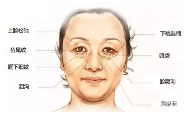 眼睛变小?这可能是眼部衰老的征兆! 图片-3