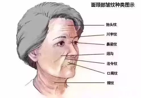 可以判断一个人衰老指标的部位——苹果肌 图片-5
