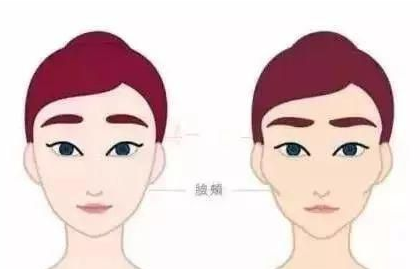 ​什么样的脸看起来不显老?答案就是:饱满 图片-6