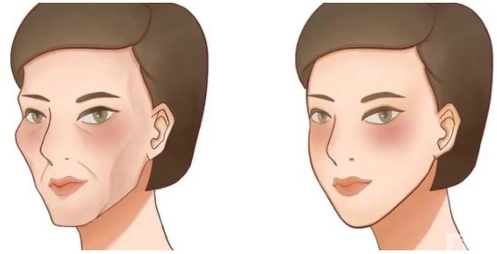 如何通过微调获得少女感? 图片-8