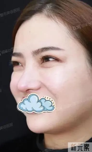 鱼尾纹蔓延眼角，你还在任由这些纹路“爬满”你的脸吗? 图片-16