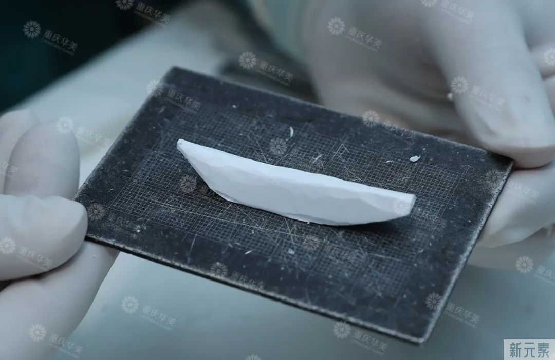 鼻子透光就一定是整了吗? 图片-9