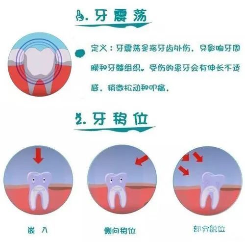 牙齿“晃了”?不要慌!这样做能缓解 图片-5