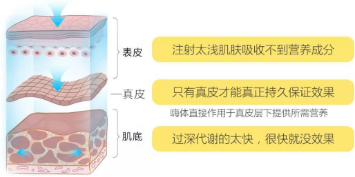 都说嗨体是颈纹克星，它的效果真的这么牛吗? 图片-4