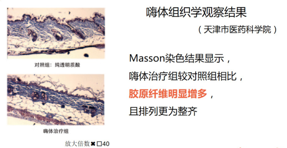 都说嗨体是颈纹克星，它的效果真的这么牛吗? 图片-5