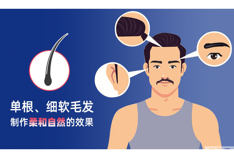 植发可以用别人的毛囊吗?可以用体毛吗? 图片-3
