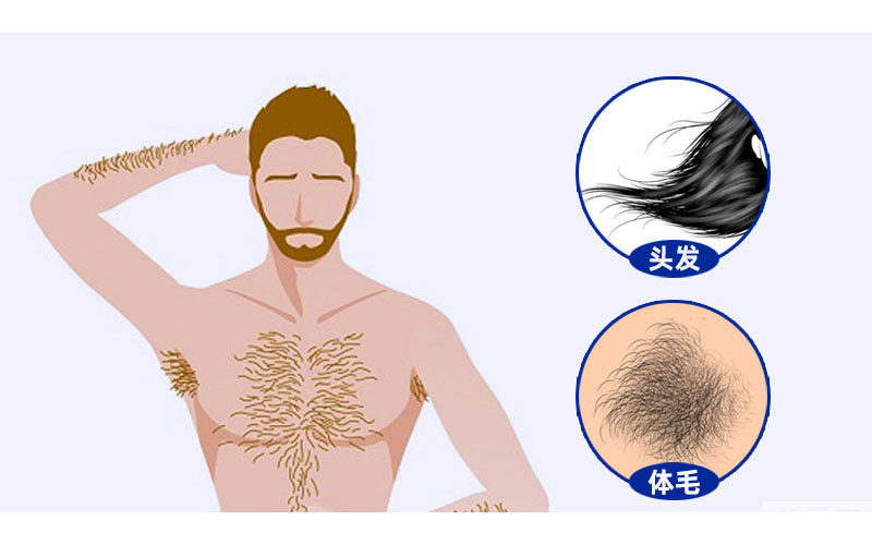 植发可以用别人的毛囊吗?可以用体毛吗? 图片-4