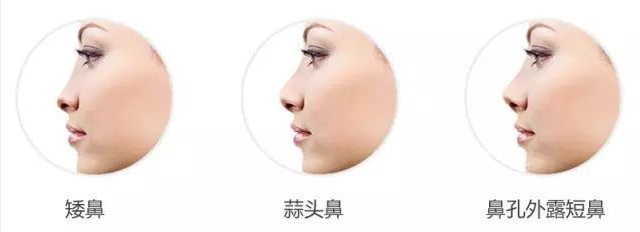 终于扒到隆鼻秘诀!快看看如何拥有自然款的“妈生鼻”? 图片-19