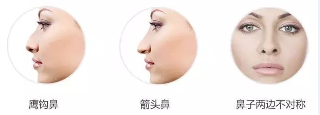 终于扒到隆鼻秘诀!快看看如何拥有自然款的“妈生鼻”? 图片-20